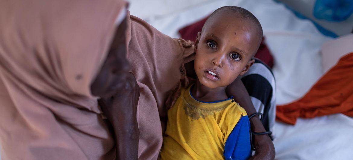 Unicef alerta desnutrición aguda severa infantil en Somalia Cuba Si