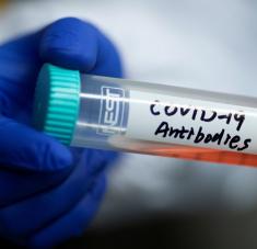 El hallazgo podría ayudar al diseño de vacunas y terapias para el SARS-CoV-2 y para otros coronavirus que puedan surgir en el futuro. Foto: Reuters