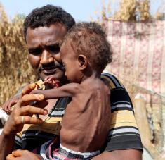 Según el secretario general de Naciones Unidas, República Democrática del Congo, Yemen, el noreste de Nigeria y Sudán del Sur son escenario de "las mayores crisis alimentarias del mundo". Foto: Reuters.