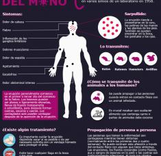 Infografía Viruela del Mono Cubasi