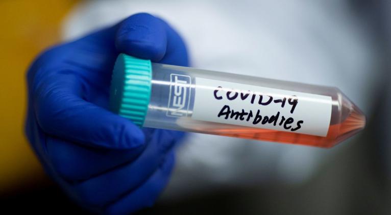 El hallazgo podría ayudar al diseño de vacunas y terapias para el SARS-CoV-2 y para otros coronavirus que puedan surgir en el futuro. Foto: Reuters