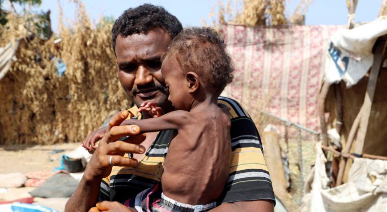 Según el secretario general de Naciones Unidas, República Democrática del Congo, Yemen, el noreste de Nigeria y Sudán del Sur son escenario de "las mayores crisis alimentarias del mundo". Foto: Reuters.