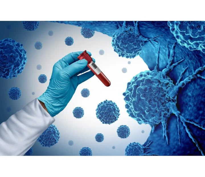 Nanopartículas + ultrasonido contra el cáncer