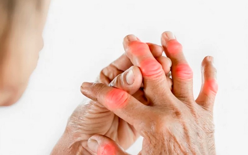 Manos padeciendo de artritis