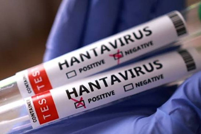 test positivo a hantavirus 